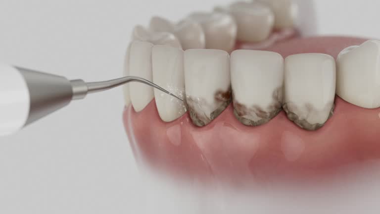 Trusted Root Canal Treatment service in Tuckerton, NJ - Dentist Open Now